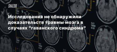 Исследования не обнаружили доказательств травмы мозга в случаях «гаванского синдрома»